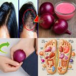 Douleurs aux jambes, rhumatismes, varices, arthrite ? Essayez ce remède naturel à base de clous de girofle et d’ail