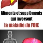 Si un tendon se soulève lorsque vous touchez votre auriculaire avec votre pouce, voici ce que cela signifie