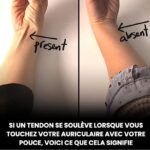 10 Aliments et suppléments qui inversent la maladie du foie